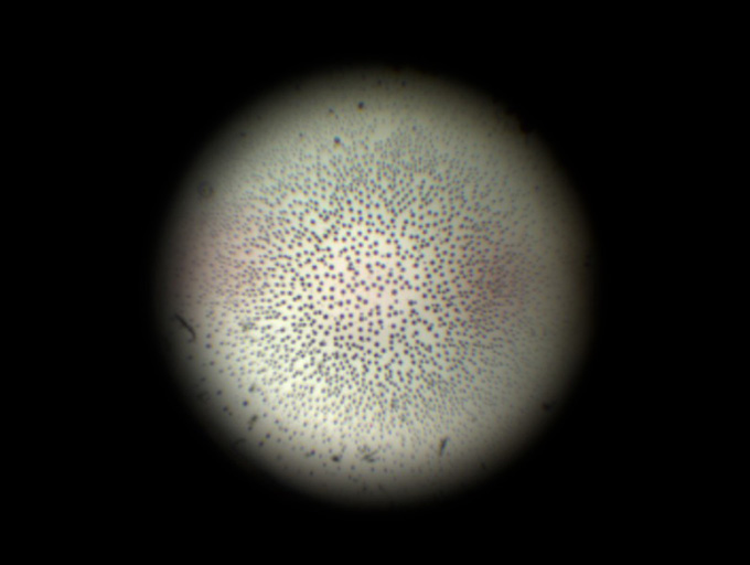 Particles-1